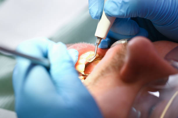Best Emergency Care for Gum Disease in North Oaks, MN