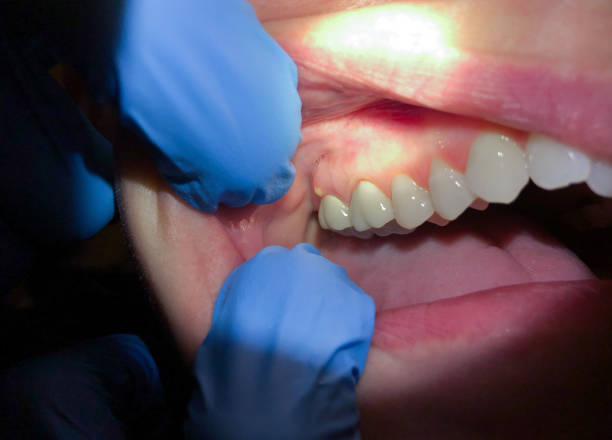 Best Emergency Root Canal Therapy in North Oaks, MN